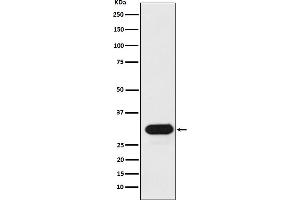 Western blot analysis of HLA-Drb1 expression in Ramos cell lysate.