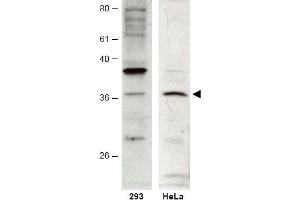 Image no. 1 for anti-HUS1 Checkpoint Homolog B (HUS1B) (AA 104-117) antibody (ABIN401265) (HUS1B anticorps  (AA 104-117))