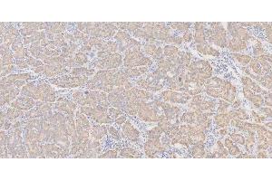 IHC analysis of GLS using anti-GLS antibody (ABIN7601603). (Glutaminase anticorps  (AA 396-654))