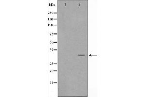 Western blot analysis on Jurkat cell lysate using MAST4 Antibody，The lane on the left is treated with the antigen-specific peptide. (MAST4 anticorps  (N-Term))