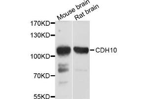 Western blot analysis of extract of mouse brain and rat brain cells, using CDH10 antibody. (CDH10 anticorps)