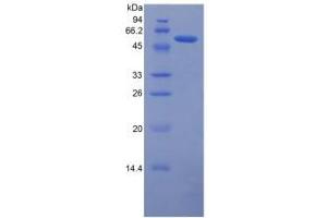 SDS-PAGE analysis of Human Ferroportin Protein. (SLC40A1 Protéine)