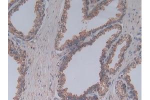 Detection of C5a in Human Prostate Tissue using Polyclonal Antibody to Complement Component 5a (C5a)