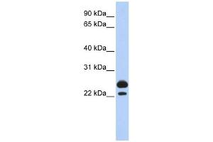 AK1 antibody used at 1 ug/ml to detect target protein. (Adenylate Kinase 1 anticorps  (Middle Region))