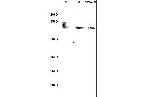 Lane 1: mouse heart lysates Lane 2: mouse kidney lysates probed with Anti PABP (Methyl Arg455/460) Polyclonal Antibody, Unconjugated (ABIN704831) at 1:200 in 4C.