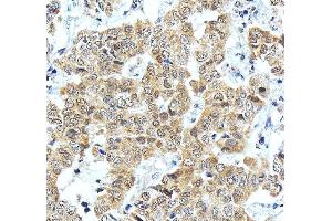 IHC analysis of ONECUT1 using anti-ONECUT1 antibody (ABIN7599190).