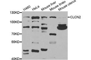 Western Blotting (WB) image for anti-Chloride Channel 2 (CLCN2) antibody (ABIN1877106)