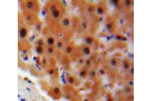 IHC-P analysis of Liver tissue, with DAB staining. (STAT2 anticorps  (AA 616-849))