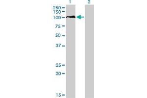 Western Blotting (WB) image for anti-DEAD (Asp-Glu-Ala-Asp) Box Polypeptide 54 (DDX54) (AA 778-882) antibody (ABIN599302) (DDX54 anticorps  (AA 778-882))