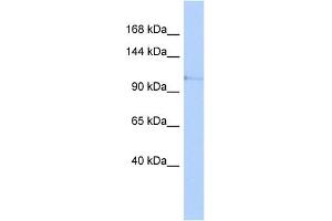 WB Suggested Anti-TLR5 Antibody Titration: 0. (TLR5 anticorps  (N-Term))