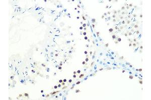 Immunohistochemistry of paraffin-embedded mouse testis using DKC1 Rabbit mAb (ABIN7266869) at dilution of 1:100 (40x lens). (DKC1 anticorps)