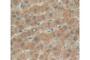 Used in DAB staining on fromalin fixed paraffin- embedded liver tissue