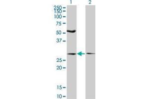 Western Blot analysis of IFT57 expression in transfected 293T cell line by IFT57 monoclonal antibody (M04), clone 3G4. (IFT57 anticorps  (AA 214-312))