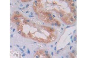 Used in DAB staining on fromalin fixed paraffin- embedded Kidney tissue (TRIP6 anticorps  (AA 279-476))