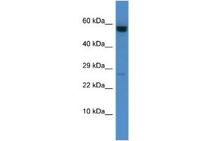Host: Rabbit Target Name: CASP10 Sample Type: HCT15 Whole Cell lysates Antibody Dilution: 1. (Caspase 10 anticorps  (C-Term))