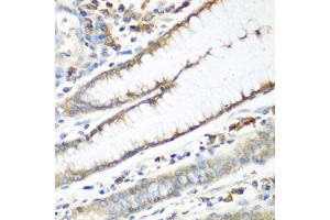 Immunohistochemistry of paraffin-embedded human stomach using CAD antibody (ABIN5974557) at dilution of 1/100 (40x lens). (CAD anticorps)