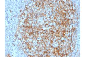 Formalin-fixed, paraffin-embedded human Lymph Node stained with CD14 Mouse Monoclonal Antibody (LPSR/2408). (CD14 anticorps  (AA 25-148))