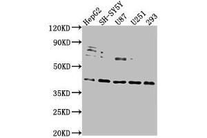 Western Blot Positive WB detected in: HepG2 whole cell lysate, SH-SY5Y whole cell lysate, U87 whole cell lysate, U251 whole cell lysate, 293 whole cell lysate All lanes: LRTM2 antibody at 1:2000 Secondary Goat polyclonal to rabbit IgG at 1/50000 dilution Predicted band size: 42 kDa Observed band size: 42 kDa