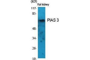Western Blot (WB) analysis of specific cells using PIAS 3 Polyclonal Antibody.