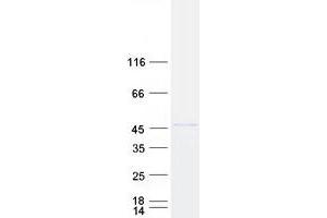 Validation with Western Blot