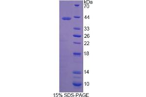 Image no. 1 for Latrophilin 3 (LPHN3) (AA 1105-1447) protein (His tag) (ABIN6236637) (LPHN3 Protein (AA 1105-1447) (His tag))