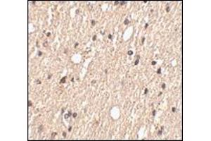 Immunohistochemistry of Spred1 in human brain tissue with this product at 2. (SPRED1 anticorps  (Center))