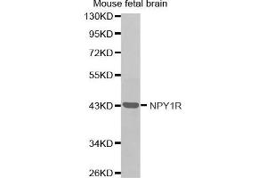 Western Blotting (WB) image for anti-Neuropeptide Y Receptor Y1 (NPY1R) antibody (ABIN3017402) (NPY1R anticorps)
