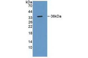 Western blot analysis of recombinant Human ROS1. (ROS1 anticorps  (AA 1945-2222))