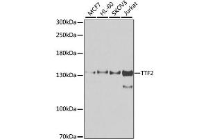 Western blot analysis of extracts of various cell lines, using TTF2 antibody. (TTF2 anticorps)