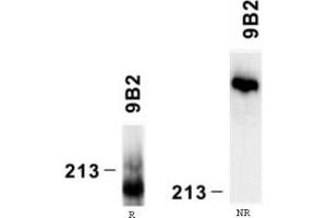 Reactivity of laminin alpha4 chain specific monoclonal antibody 9B8 on human platelet lysate by Western blotting (reducing, R and nonreducing, NR conditions). (LAMa4 anticorps)