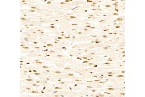 Immunohistochemistry analysis of paraffin-embedded rat heart using,GSTT1 (ABIN7074091) at dilution of 1: 2000