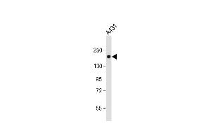 Anti-PRDM10 Antibody at 1:1000 dilution + A431 whole cell lysate Lysates/proteins at 20 μg per lane. (PRDM10 anticorps  (N-Term))