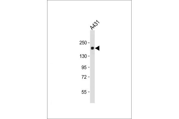 PRDM10 anticorps  (N-Term)