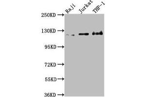 Western Blot Positive WB detected in: Raji whole cell lysate, Jurkat whole cell lysate, THP-1 whole cell lysate All lanes: MICAL1 antibody at 1:2000 Secondary Goat polyclonal to rabbit IgG at 1/50000 dilution Predicted band size: 118, 109, 38, 120 kDa Observed band size: 120 kDa (MICAL1 anticorps  (AA 806-1067))