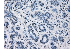 Immunohistochemical staining of paraffin-embedded breast tissue using anti-CYP2E1 mouse monoclonal antibody. (CYP2E1 anticorps)