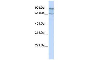 MAP4K2 antibody used at 1 ug/ml to detect target protein.