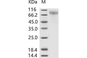 Western Blotting (WB) image for Respiratory Syncytial Virus Glycoprotein (RSV G) protein (His tag) (ABIN7198762)