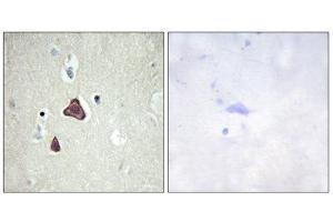 Immunohistochemistry (IHC) image for anti-Adenylate Cyclase 8 (Brain) (ADCY8) (Internal Region) antibody (ABIN1850180)