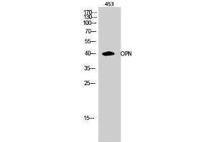 Western Blotting (WB) image for anti-Secreted phosphoprotein 1 (SPP1) (C-Term) antibody (ABIN3186218) (Osteopontin anticorps  (C-Term))