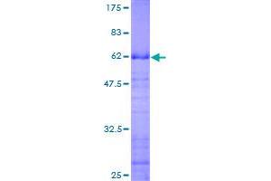 Image no. 1 for Inhibitor of Growth Family, Member 2 (ING2) (AA 1-280) protein (GST tag) (ABIN1307911)