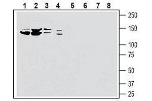 Western blot analysis of human HL-60 myelocytic leukemia cell line lysate (lanes 1 and 5), human K562 chronic myelogenous leukemia cell line lysate (lanes 2 and 6), human MCF-7 breast adenocarcinoma cell line lysate (lanes 3 and 7) and human PANC-1 pancreatic carcinoma cell line lysate (lanes 4 and 8): - 1-4. (SLC28A3 anticorps  (5th Extracellular Loop))