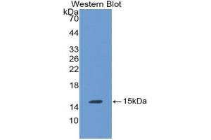 Detection of Recombinant LHb, Rat using Monoclonal Antibody to Luteinizing Hormone Beta Polypeptide (LHb) (LHB anticorps  (AA 21-141))