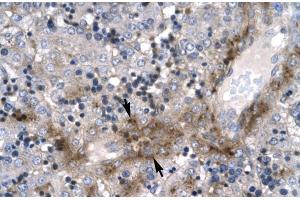 Human Liver; Rabbit Anti-ZNF365 Antibody. (ZNF365 anticorps  (N-Term))