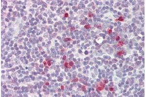 Image no. 2 for anti-cAMP-Regulated phosphoprotein, 21kDa (ARPP21) (AA 74-123) antibody (ABIN6749725) (ARPP21 anticorps  (AA 74-123))