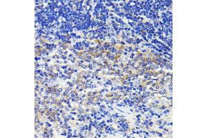 Immunohistochemistry of paraffin-embedded rat spleen using  antibody  at dilution of 1:100 (40x lens).