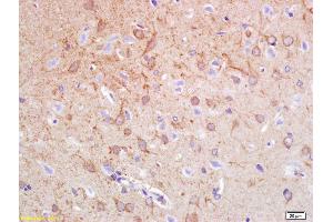 Formalin-fixed and paraffin embedded rat brain labeled with Anti-Synphilin-1 Polyclonal Antibody, Unconjugated (ABIN736163) at 1:200 followed by conjugation to the secondary antibody and DAB staining. (SNCAIP anticorps  (AA 51-150))