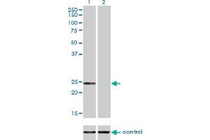 Western blot analysis of AK1 over-expressed 293 cell line, cotransfected with AK1 Validated Chimera RNAi (Lane 2) or non-transfected control (Lane 1). (Adenylate Kinase 1 anticorps  (AA 1-194))