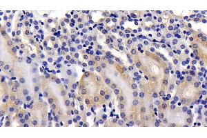 Detection of ATG7 in Mouse Kidney Tissue using Polyclonal Antibody to Autophagy Related Protein 7 (ATG7)
