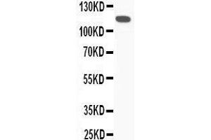 Western Blotting (WB) image for anti-Complement Component 5 (C5) (AA 1-18), (N-Term) antibody (ABIN3044294)