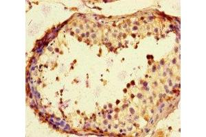 Immunohistochemistry of paraffin-embedded human testis tissue using ABIN7169195 at dilution of 1:100 (TBK1 anticorps  (AA 364-585))